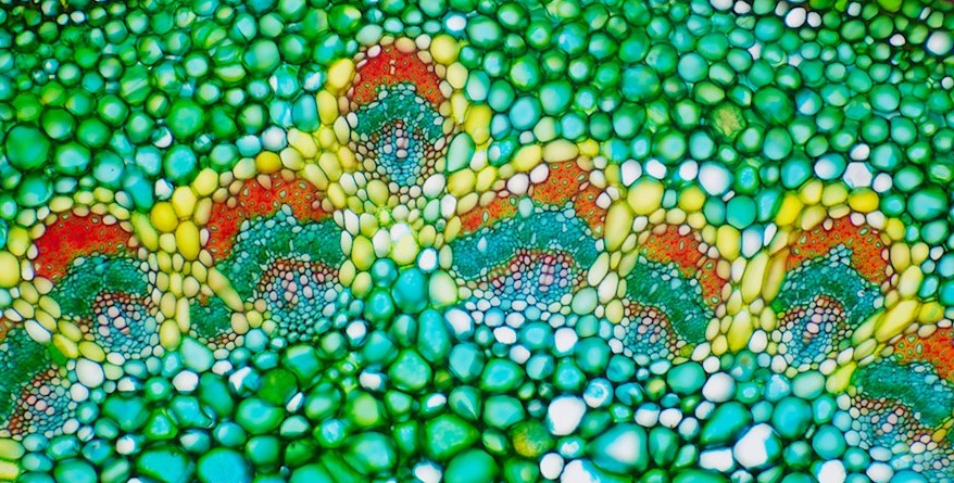 Cross-section of a rose pedicel, 10x magnification
